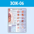 Плакат «Венерические заболевания» (ЗОЖ-06, пластик 2 мм, A1, 1 лист)